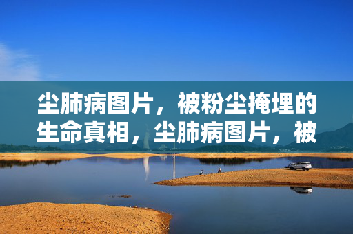 尘肺病图片，被粉尘掩埋的生命真相，尘肺病图片，被粉尘掩埋的生命真相